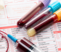 blood test blood samples on a laboratory form feature